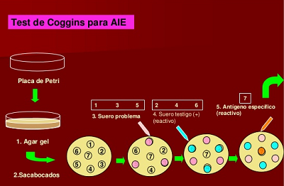 Test de Coggins